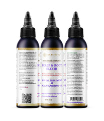 Natural scalp treatment for itchy, dry scalp