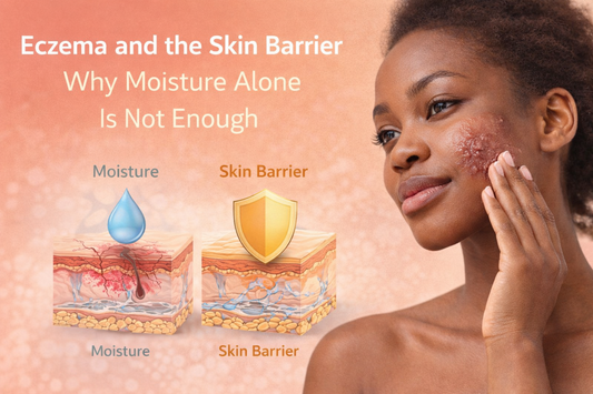 Illustration showing the skin barrier and SheaXpress eczema relief skincare supporting sensitive, eczema-prone skin and barrier repair.