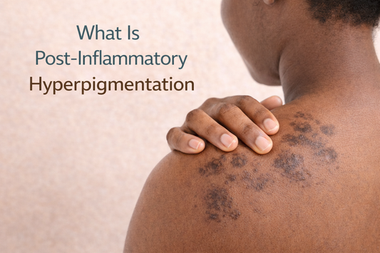 What Is Post-Inflammatory Hyperpigmentation